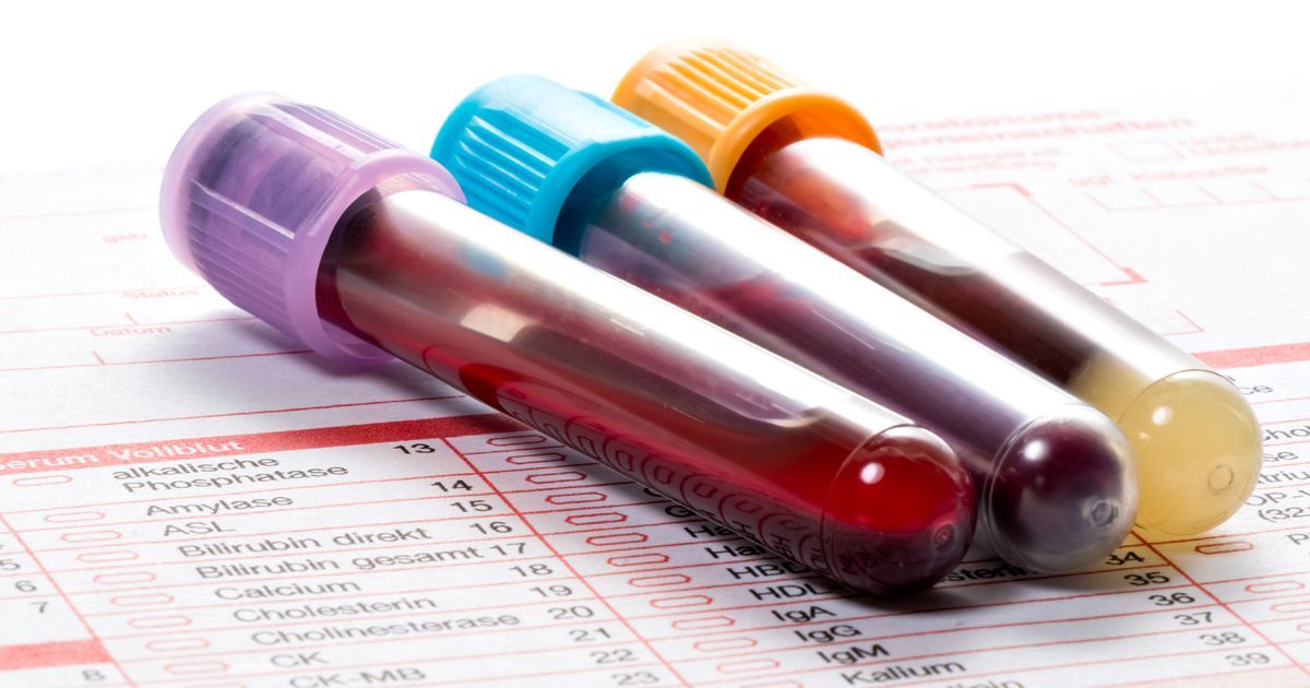 Que recommandez-vous de tester lors d'une analyse de sang de routine ?