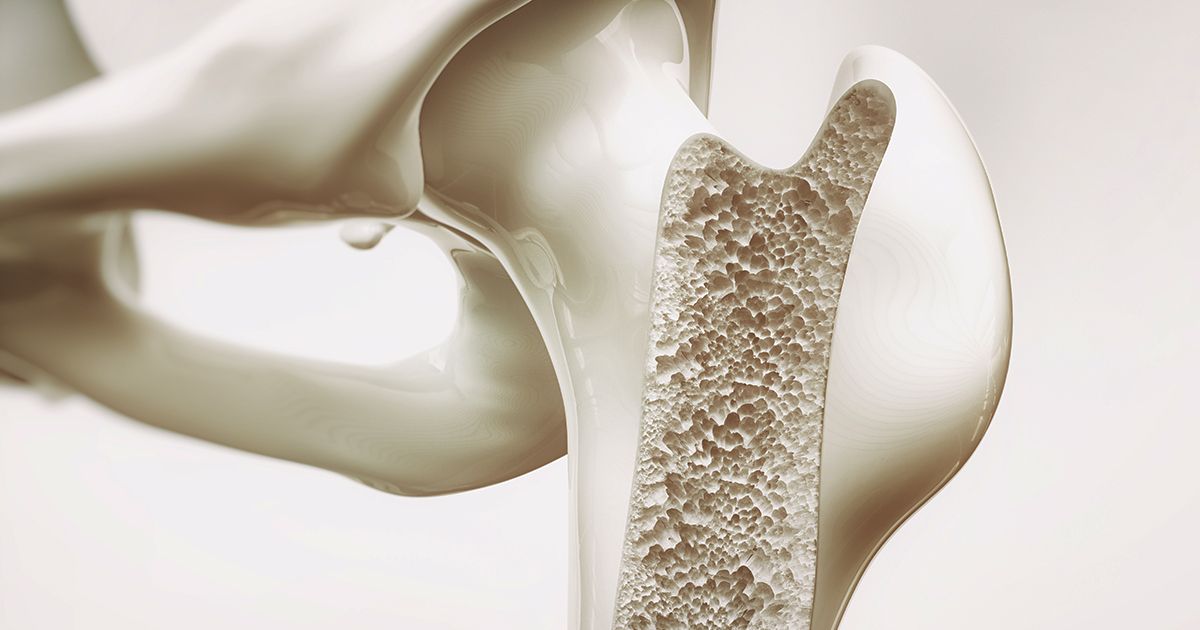 La plupart des gens l'ignorent jusqu'à ce qu'ils aient une fracture