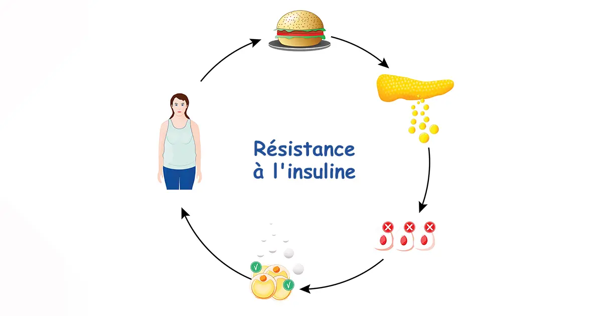 La relation entre la résistance à l'insuline et l'accélération des maladies