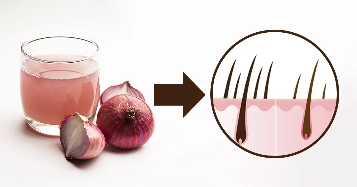 Le jus d'oignon peut-il inverser l'amincissement des cheveux et ralentir le grisonnement ?