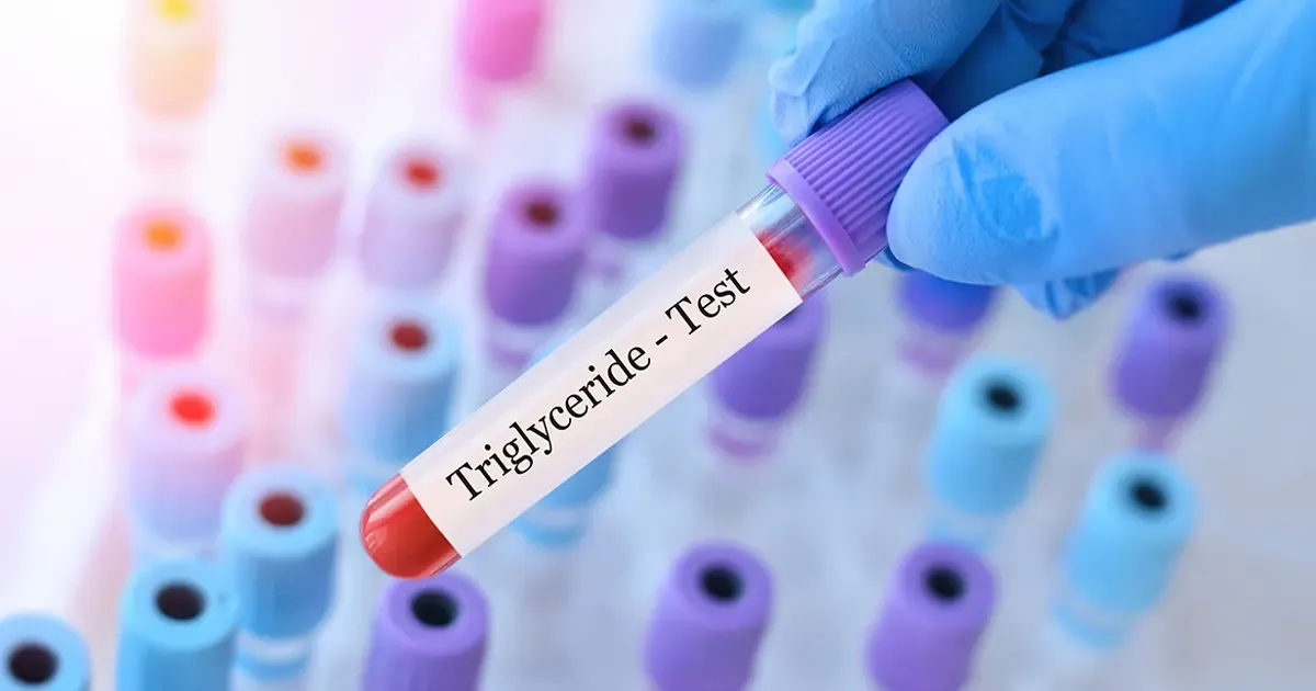 Les meilleures stratégies pour réduire vos triglycérides