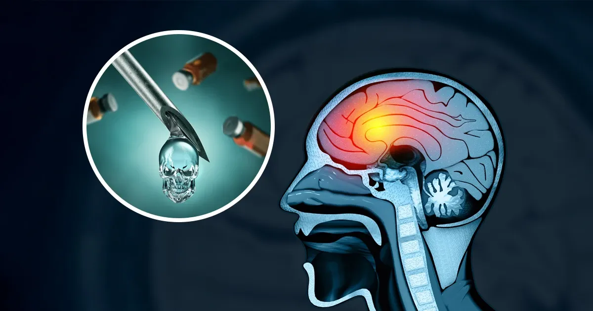 La vérité sur les accidents neurologiques que la mythologie officielle a choisi d'oublier