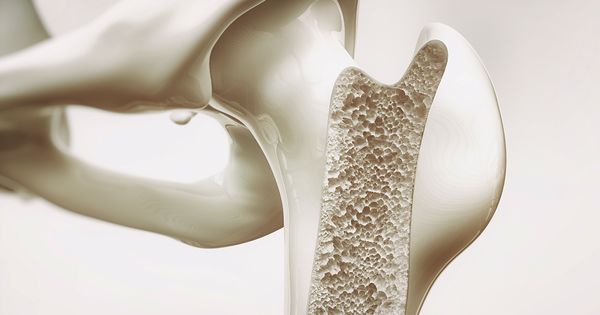 La plupart des gens l'ignorent jusqu'à ce qu'ils aient une fracture