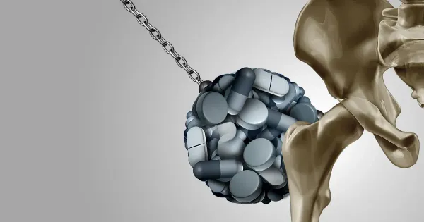 Les médicaments populaires contre les brûlures d'estomac ont un lien avec l'ostéoporose