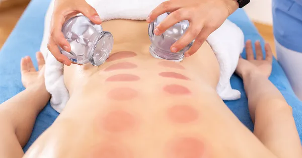 Qu’est-ce que la ‘cupping therapy’ (thérapie par les ventouses) et que peut-elle vous apporter ?