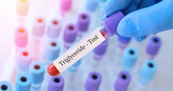 Les meilleures stratégies pour réduire vos triglycérides