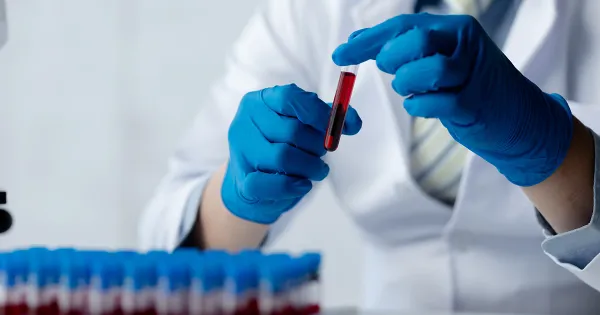 Ferritine sérique et GGT : des indicateurs essentiels pour comprendre votre santé