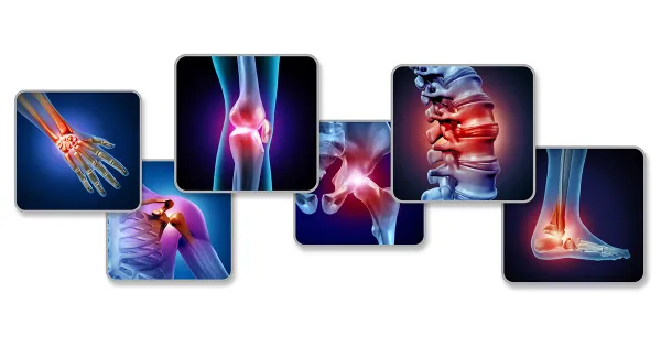 Arthrite, lupus, sclérose : et si vos médicaments faisaient pire que mieux ?